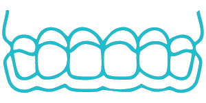 illustration of clear aligners on teeth