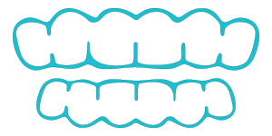 illustration of clear orthodontic retainer